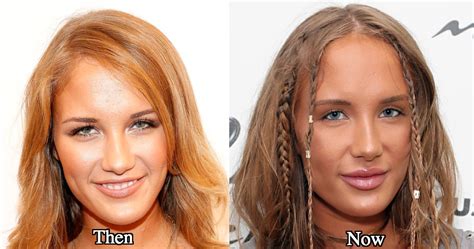 niykee heaton boobs|Niykee Heaton Plastic Surgery Photos Before and After